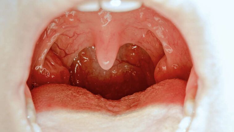 What is a Slubberdegullion?