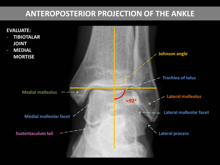 What is a Tibiotalar joint?