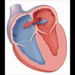 What is septa heart?