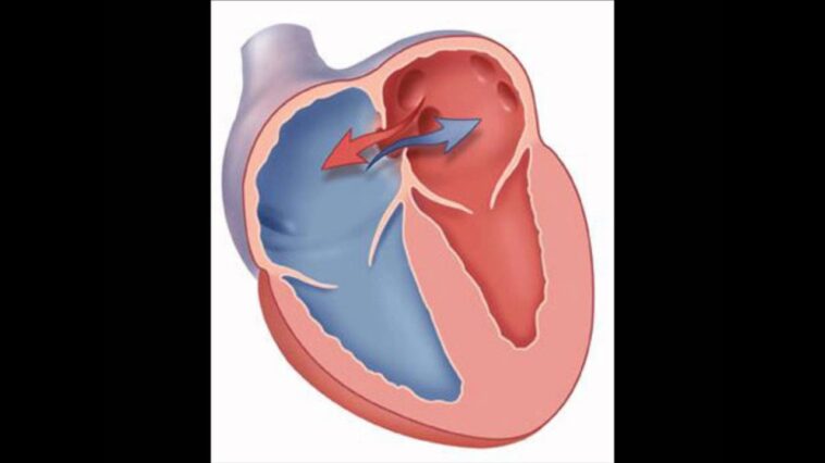 What is septa heart?