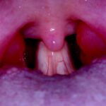 What is the difference between velum and uvula?