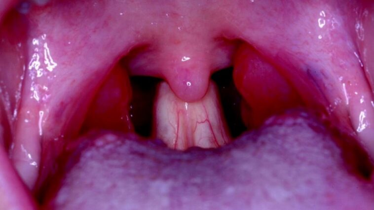 What is the difference between velum and uvula?