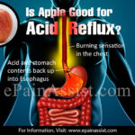 Are apples good for acid reflux?