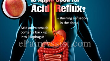Are apples good for acid reflux?