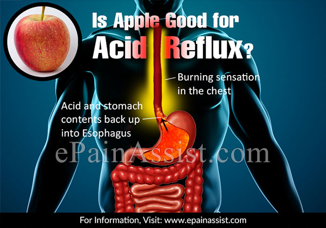 Are apples good for acid reflux?