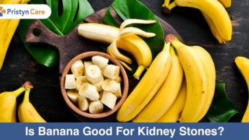 Are bananas good for kidney stones?