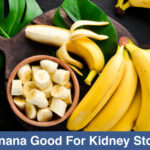 Are bananas good for kidney stones?
