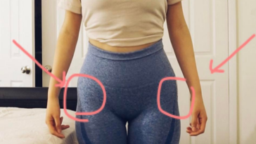 Are hip dips love handles?