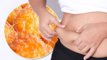 Are love handles subcutaneous or visceral fat?