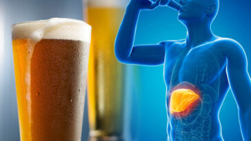 Can 3 beers a day cause liver damage?