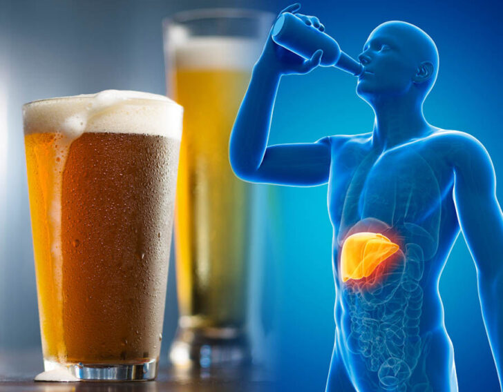 can-3-beers-a-day-cause-liver-damage