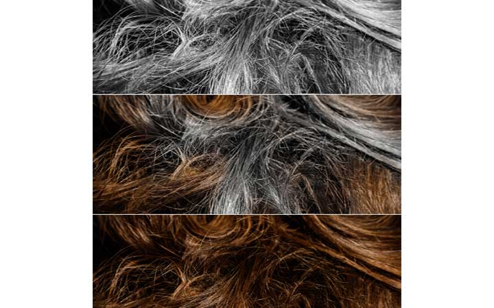 Can B12 reverse gray hair?