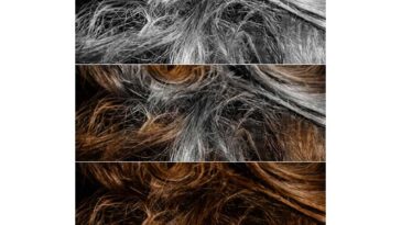 Can B12 reverse gray hair?