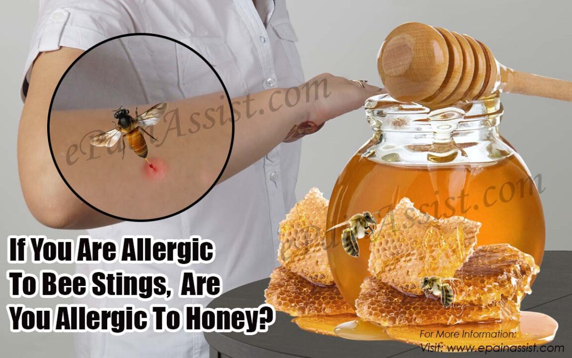 Can I eat honey if I'm allergic to bees?