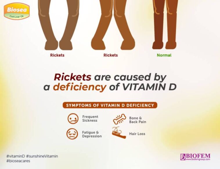 Can a vitamin D deficiency cause dehydration?