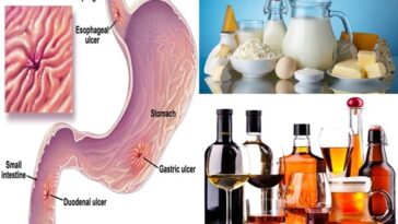 Can an ulcer patient eat noodles?