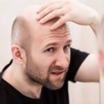 Can balding hair grow back?