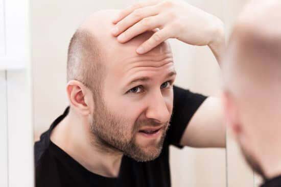 Can balding hair grow back?