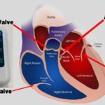 Can damage caused by high blood pressure be reversed?