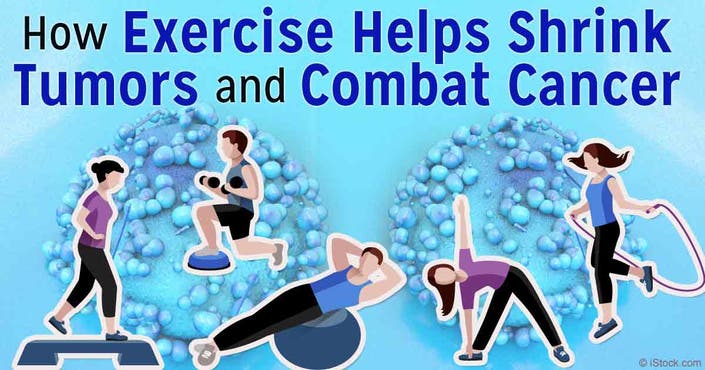 Can exercise shrink tumors?