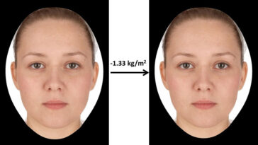 Can losing 20 pounds make a difference in your face?