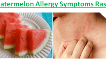 Can quinoa cause allergic reactions?