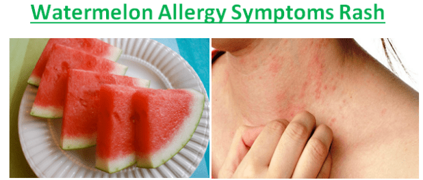 Can quinoa cause allergic reactions?