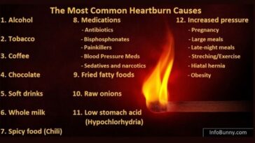 Can spicy cause heartburn?