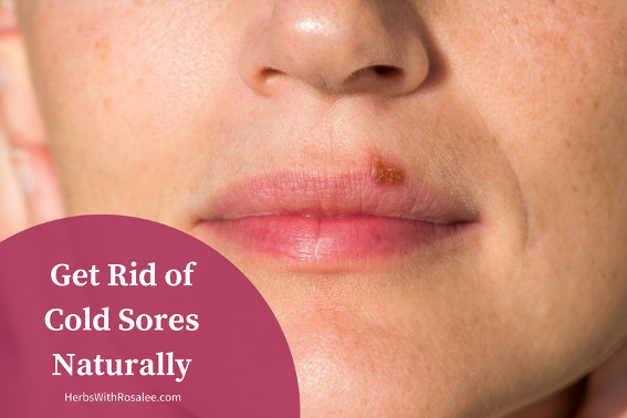 Can vitamin C cause cold sores?