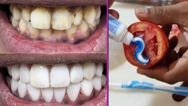 Can yellow teeth become white?