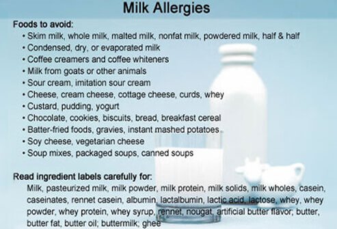 Can you be allergic to whey but not milk?