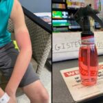 Can you get chemical burns from hand sanitizer?