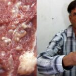 Can you get nandrolone from eating pork?