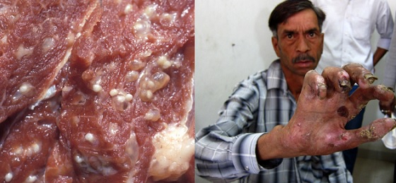 Can you get nandrolone from eating pork?