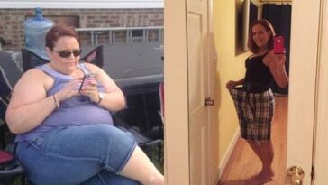 Can you lose 100 pounds without surgery?