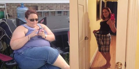 Can you lose 100 pounds without surgery?