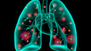 Can your body cure pneumonia on its own?