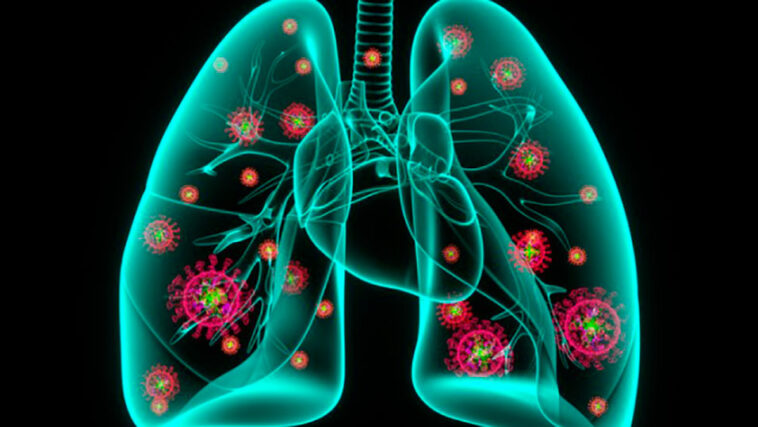 Can your body cure pneumonia on its own?