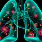 Can your body cure pneumonia on its own?