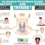 Can your thyroid make your body ache?