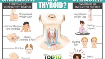 Can your thyroid make your body ache?