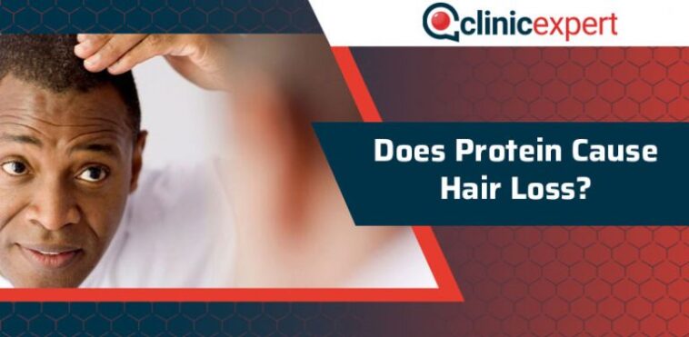 Does Ideal Protein cause hair loss?