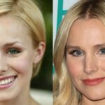 Does Kristen Bell get plastic surgery?