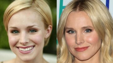 Does Kristen Bell get plastic surgery?