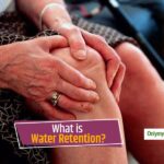 Does Tylenol cause water retention?