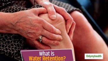 Does Tylenol cause water retention?