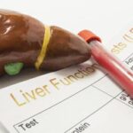 Does alcohol-free beer affect liver?