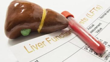 Does alcohol-free beer affect liver?