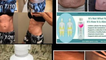 Does collagen help weight loss?