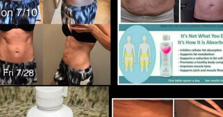 Does collagen help weight loss?